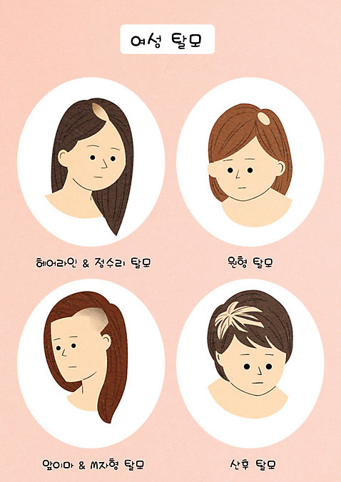 PSD 여자 일러스트 종류 여러명 성인 머리 다양 고민 부분탈모증 원형탈모 증상 탈모 탈모클리닉 성인여자만 국내일러스트 감정 다수 사람 신체부위 클리닉 여자만 성인만 파일형식