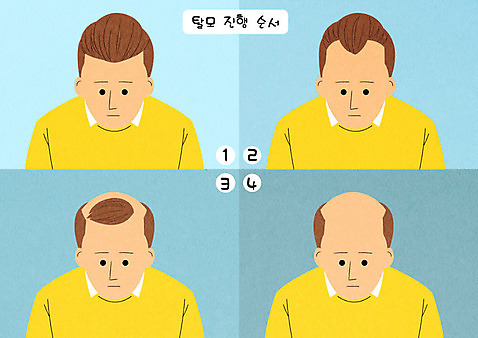 PSD 남자 일러스트 여러명 성인 머리카락 슬픔 좌절 대머리 빠짐 순서 진행 증상 탈모 탈모클리닉 국내일러스트 헤어스타일 감정 다수 컨셉 사람 머리 클리닉 파일형식
